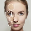 Morpheus8: Dissolving Filler and More